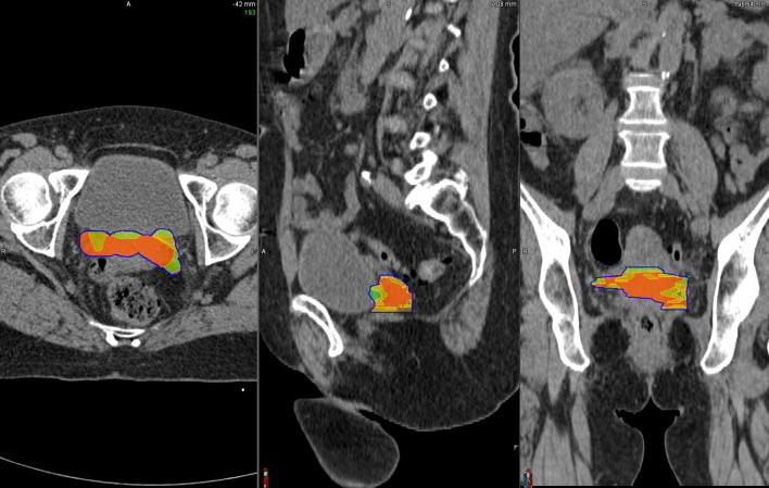 Fig. 4