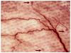 Fig. 11