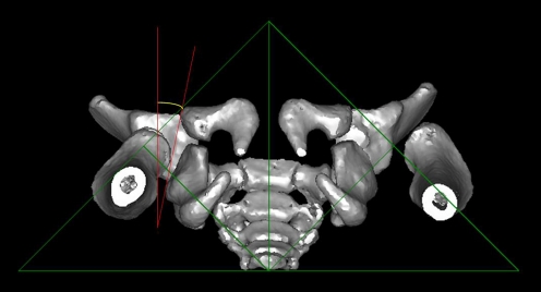 Fig. 3