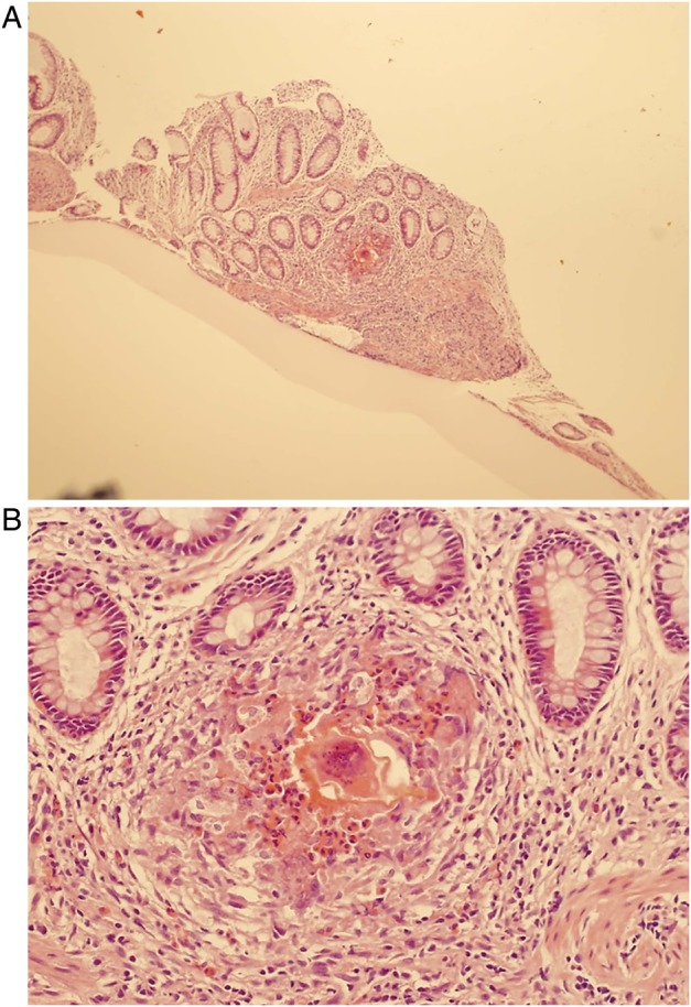 Figure 3