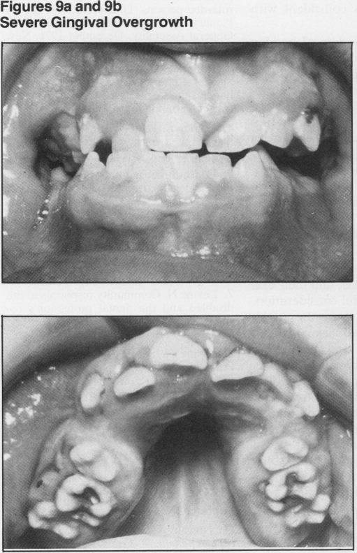 Figure 9a and 9b