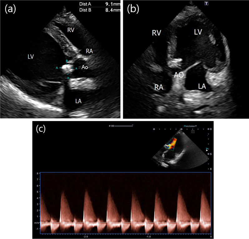 Fig. 2