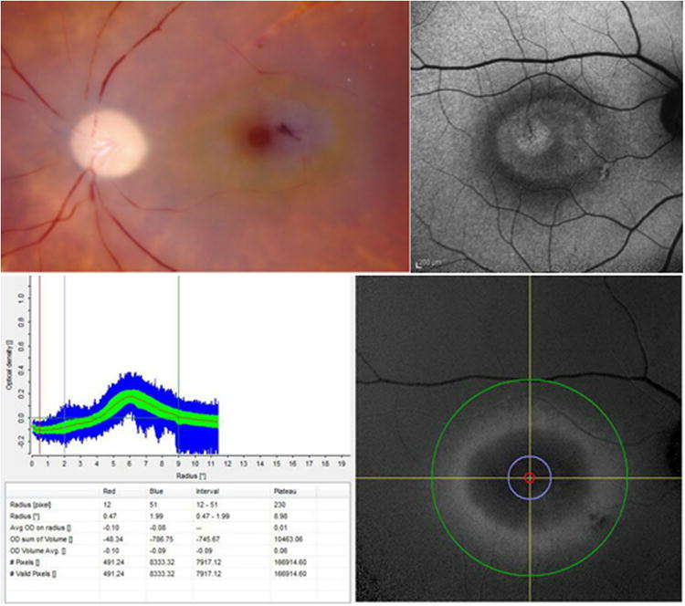 Figure 14