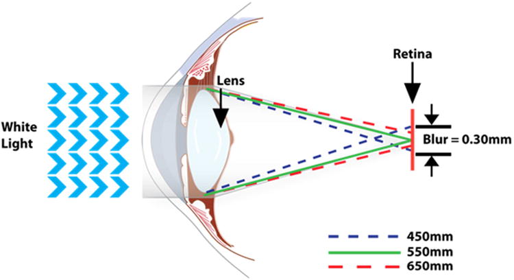 Figure 12