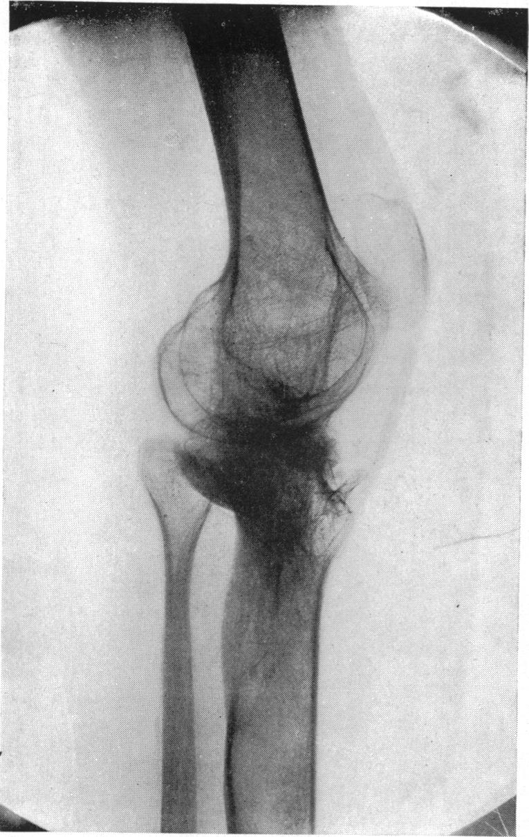 FIG. 5.