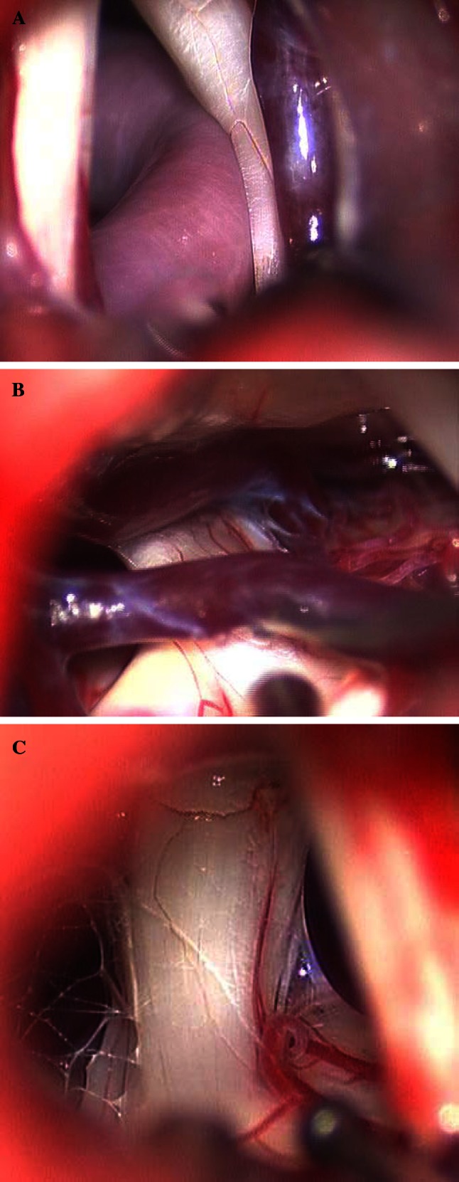 Fig. 1