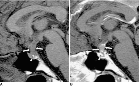 Fig. 11