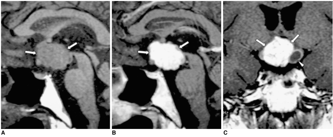 Fig. 12