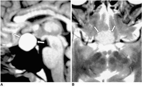 Fig. 13