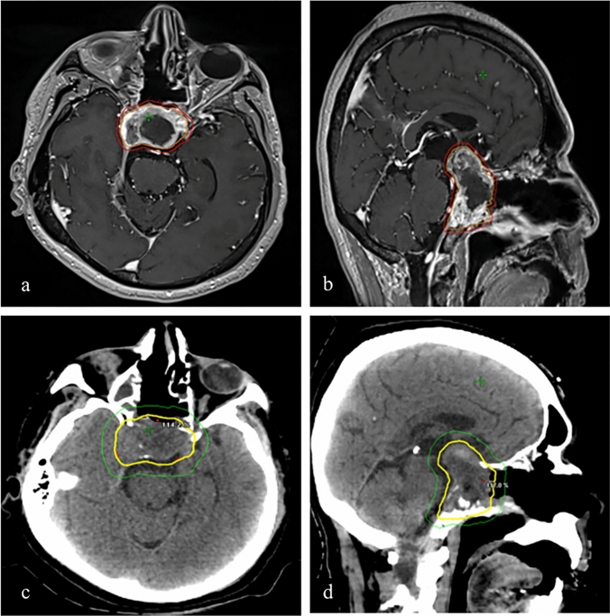 Fig. 3