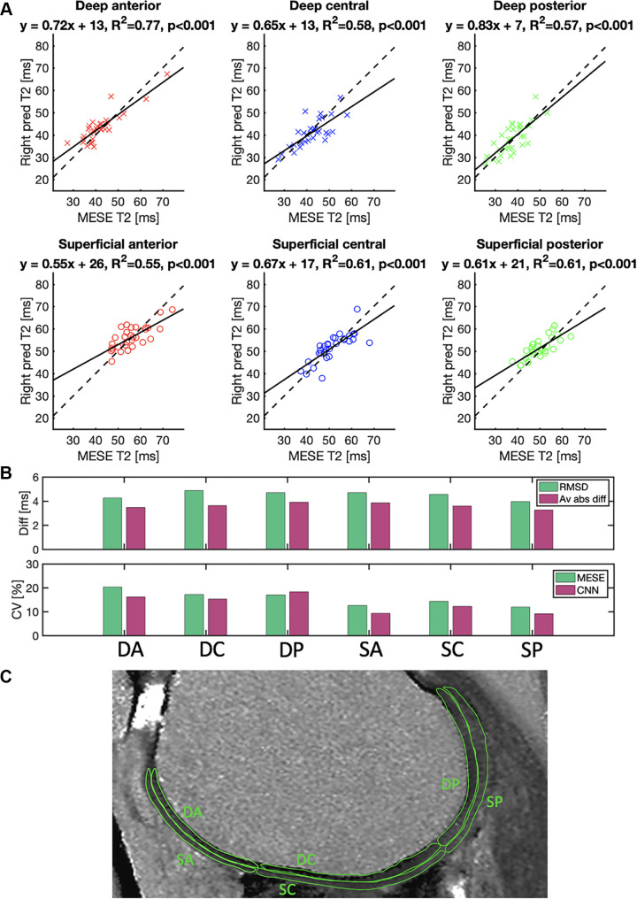 (A) Mean T2 in a region of interest drawn in the deep or superficial anterior (red), central (blue), or posterior (green) position on the femoral cartilage on images from 30 patients. Each point represents a value from a region of interest in a section of the right knee of one patient. The plots compare the reference multiecho spin-echo (MESE) T2 estimates of the right knee (x-axis) with the T2 predicted (pred) by the neural network (y-axis) of the same knee. Solid lines represent best-fit lines, and dashed lines represent y equal to x. (B) Root-mean-square differences (RMSD), average absolute differences (Av abs diff) (top), and coefficients of variation (CV) (bottom) in the cartilage regions. (C) Typical example of the different cartilage regions. CNN = convolutional neural network, DA = deep anterior, DC = deep central, diff = difference, DP = deep posterior, SA = superficial anterior, SC = superficial central, SP = superficial posterior.