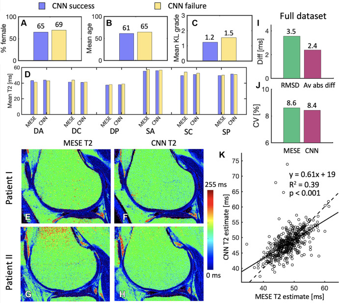 (A–C) Comparison of the subsets of the randomly selected 30 patients evaluated by the radiologists, whereby the convolutional neural network (CNN) succeeded in convincing at least one radiologist (17 patients) that it was the multiecho spin-echo (MESE) map and where it did not (13 patients). In B, age is presented in years. (D) Comparison between the success and failure sets of multiecho spin-echo (MESE) T2 and CNN T2 in the six different cartilage subregions. (E, F) Sample (E) MESE T2 map and (F) CNN T2 map in a patient for which both readers failed to recognize which map was the CNN T2 map. (G, H) Sample (G) MESE T2 map and (H) CNN T2 map on which both readers accurately recognized which image was the CNN T2 map but one or both deemed the CNN T2 map to be better in terms of signal-to-noise ratio, sharpness, artifacts, and overall quality. (I) Root-mean-square difference (RMSD) and average absolute difference (Av abs diff) between the MESE T2 and CNN T2 maps. (J) Coefficients of variation (CV) for the MESE and CNN maps. (K) Comparison of average values from the MESE and CNN T2 maps. Plot shows the results for all 456 patients in the test dataset. One point represents one patient. The solid line represents the least-squares fit line through the points, while the dashed line represents the y equal to x line. DA = deep anterior, DC = deep central, diff = difference, DP = deep posterior, KL = Kellgren-Lawrence, SA = superficial anterior, SC = superficial central, SP = superficial posterior.