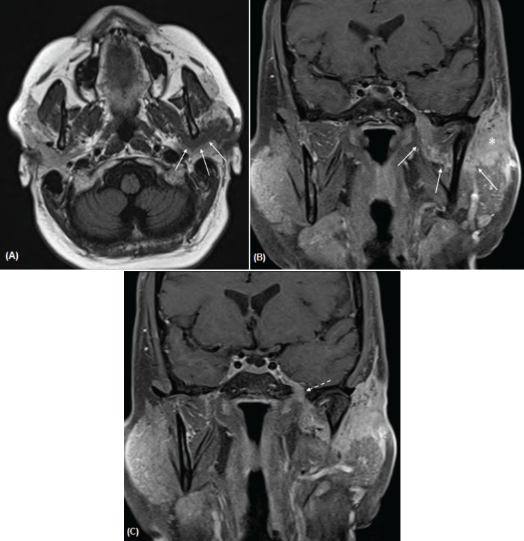 Figure 2 A–C.