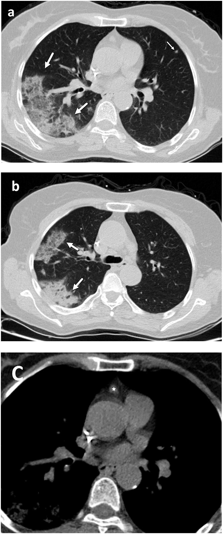 Fig. 10