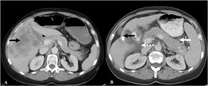 Fig. 10