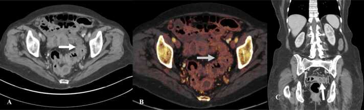 Fig. 8