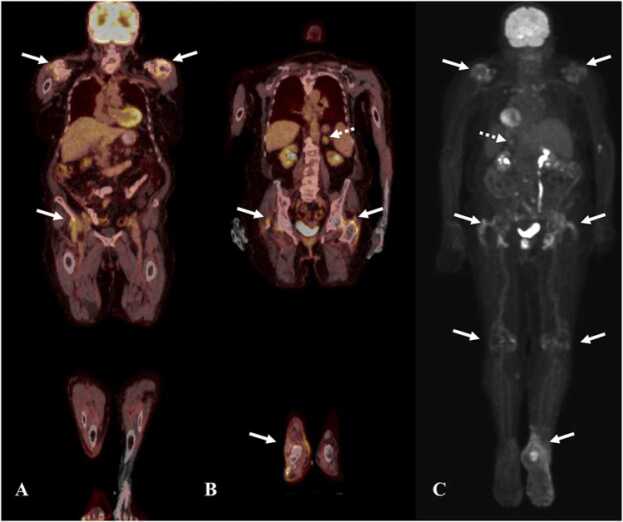 Fig. 16