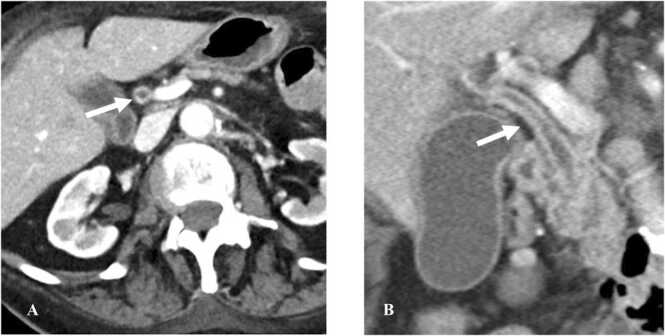 Fig. 11