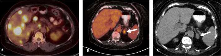 Fig. 15