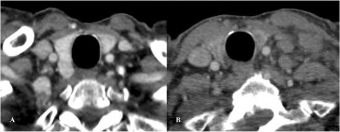 Fig. 14