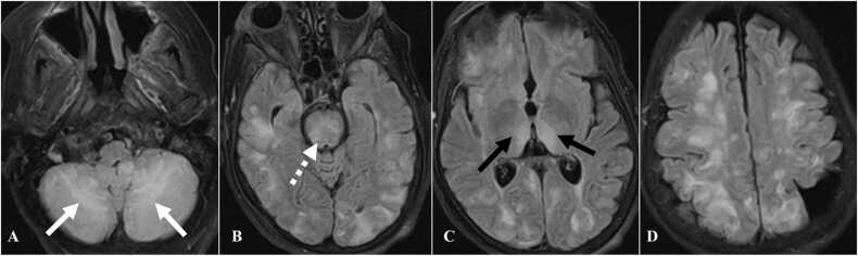 Fig. 17