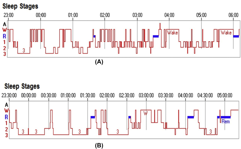 Fig. 3