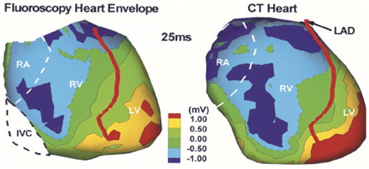 Fig. 12