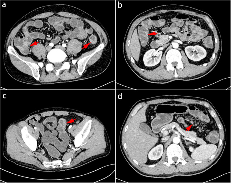 Fig. 3