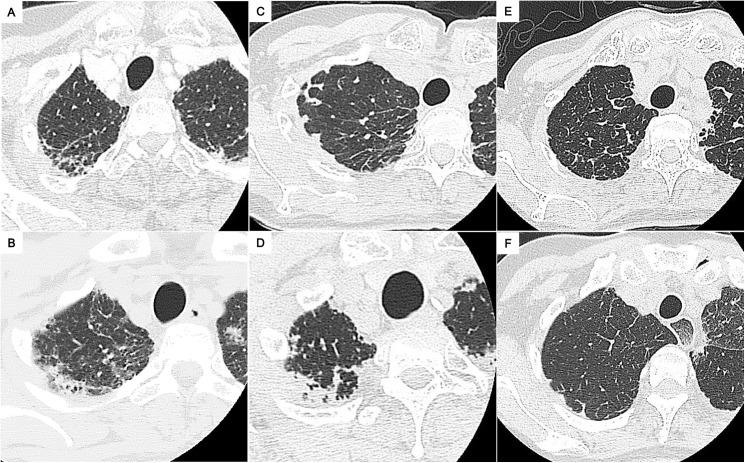 Fig 2