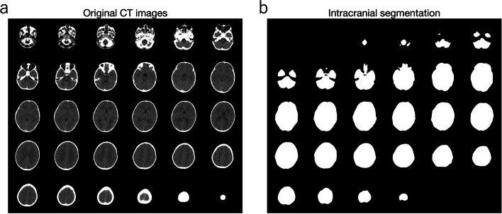 Fig. 2