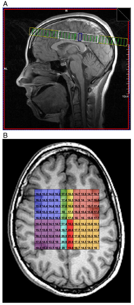 Fig. 1