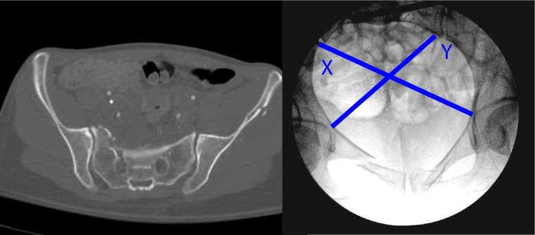 Fig. 1