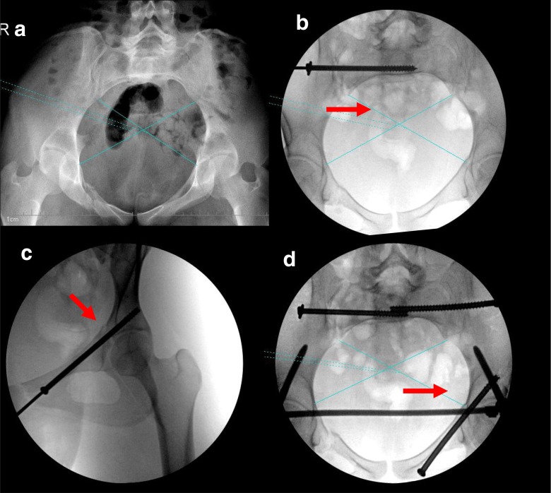 Fig. 3