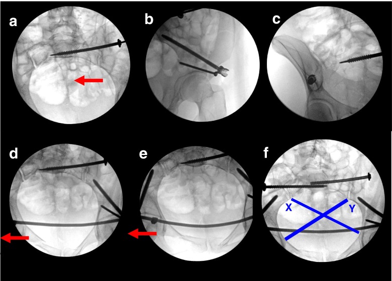 Fig. 2