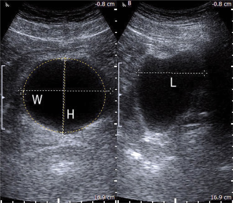 Fig. 15