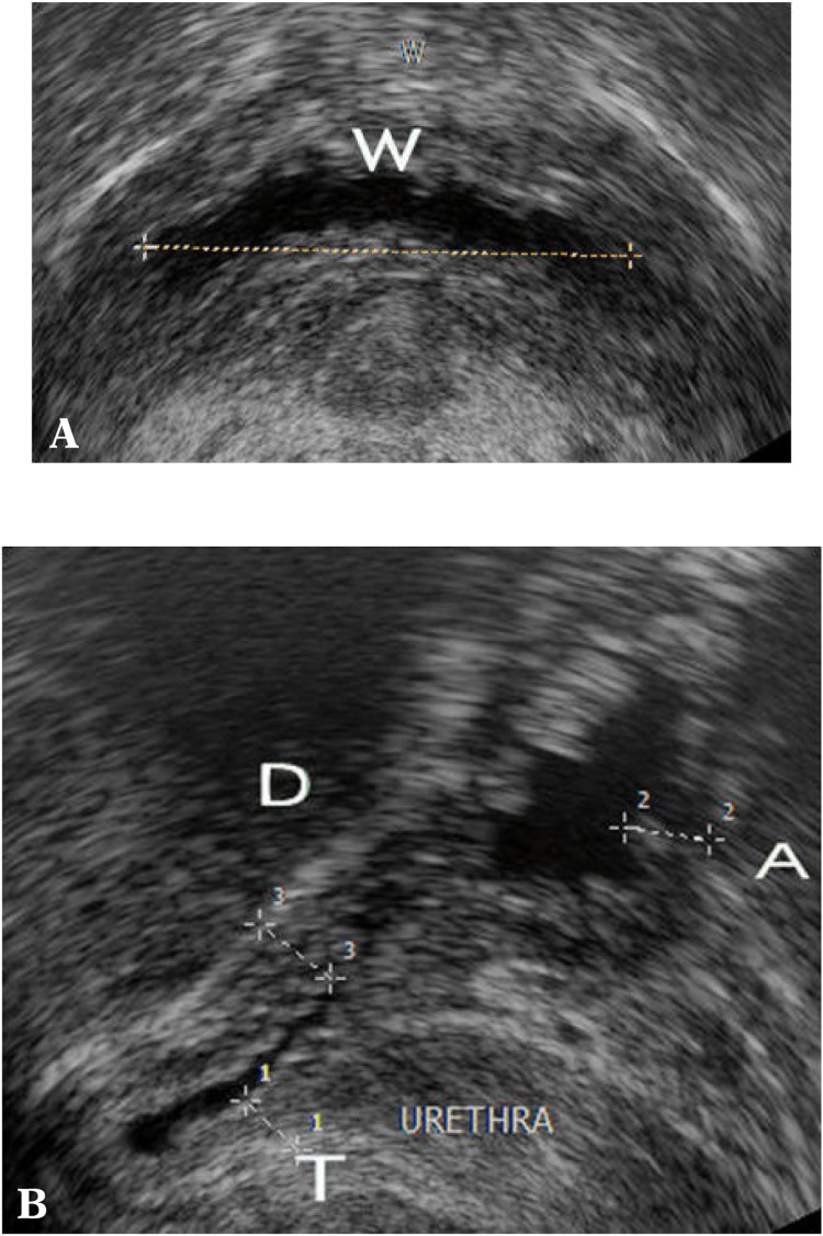 Fig. 16