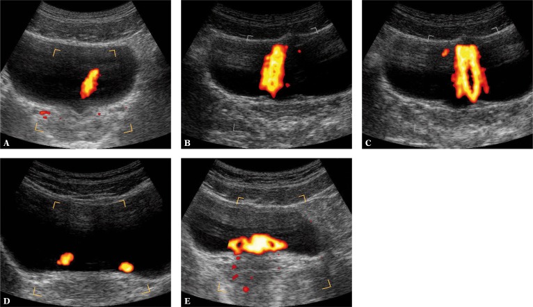 Fig. 11