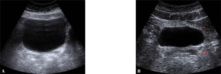 Fig. 13