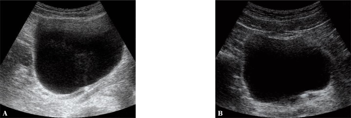 Fig. 12