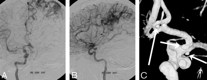 Fig 3.