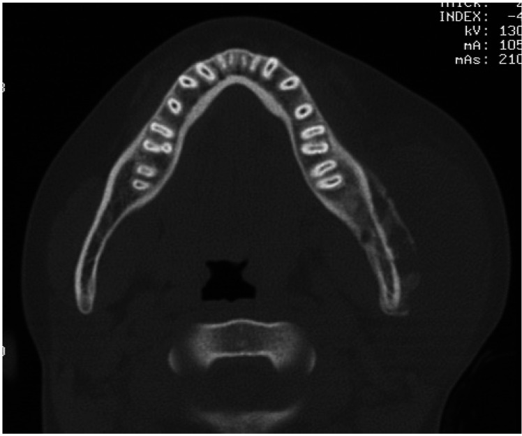 Fig. 4