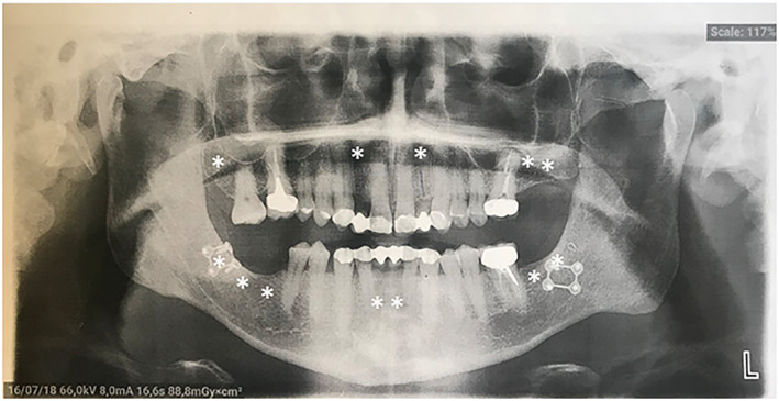 FIGURE 4