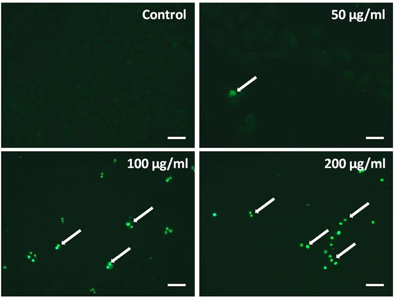 FIGURE 4