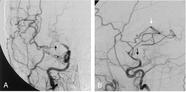 Fig 5.