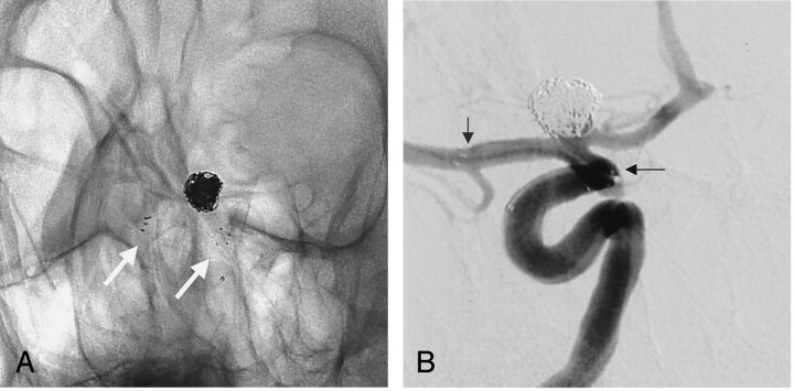 Fig 2.