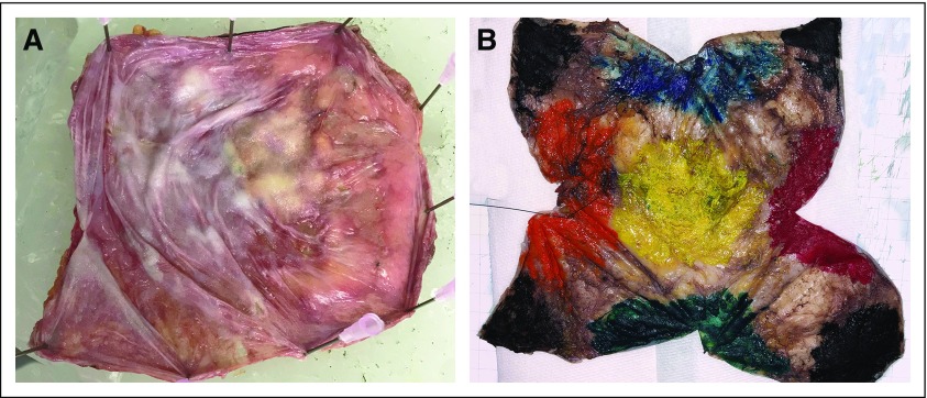 FIG A2.