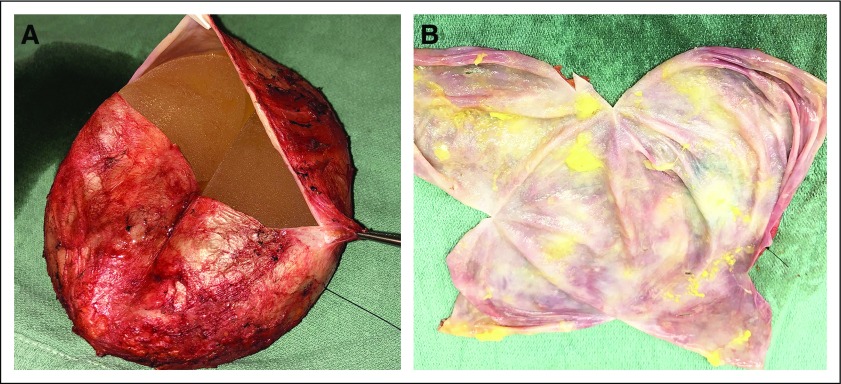 FIG 3.