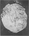 294-3