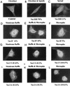 FIG. 11
