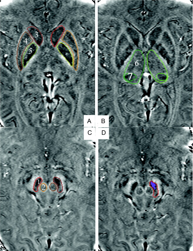 Fig 1.